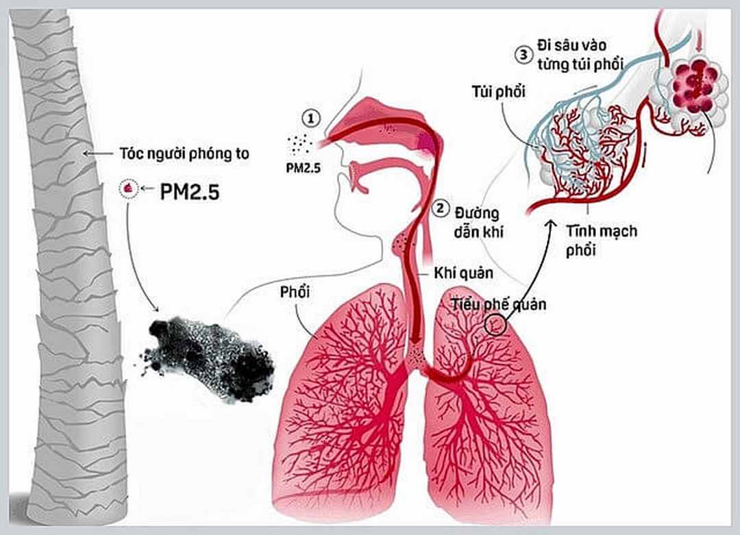 Ô nhiễm không khí là một trong những nguyên nhân gây nên các căn bệnh nguy hiểm