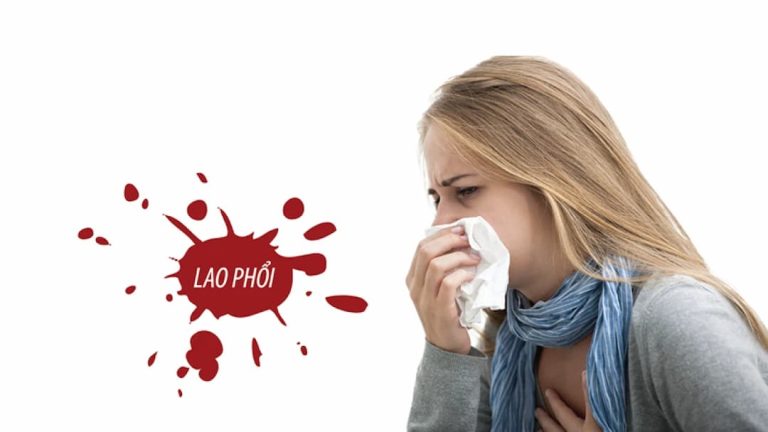 Các biện pháp hỗ trợ điều trị bệnh lao