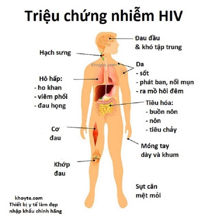 Dấu hiệu cơ bản của HIV/AIDS