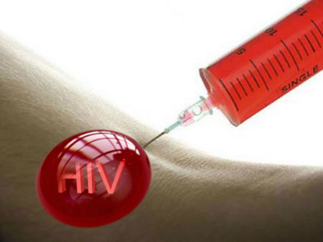 Các dấu hiệu và triệu chứng của HIV/AIDS