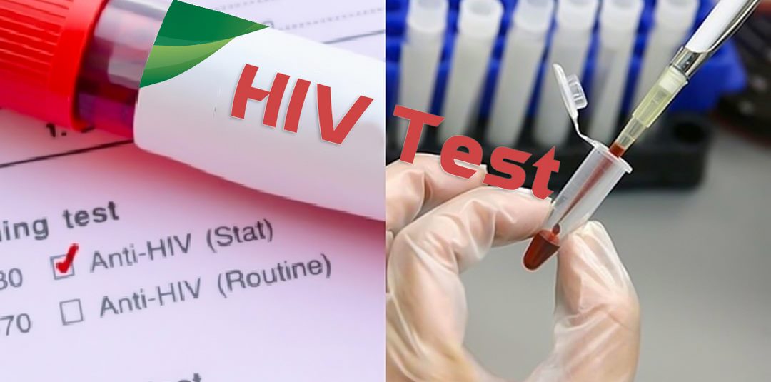 Các phương pháp điều trị HIV/AIDS